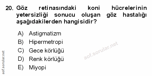 20. soru: Goz retinasındaki koni hücrelerinin yetersizliği sonucu oluşan göz hastalığı aşağıdakilerden hangisidir? A) Astigmati…