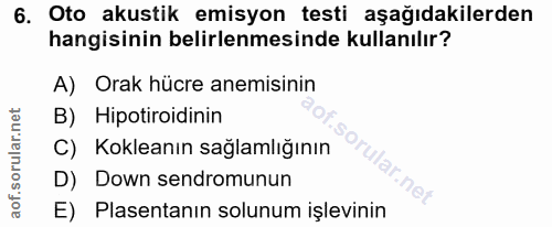 6. soru: Oto akustik emisyon testi aşağıdakilerden hangisinin belirlenmesinde kullanılır? A) Orak hücre anemisinin B) Hipotiro…