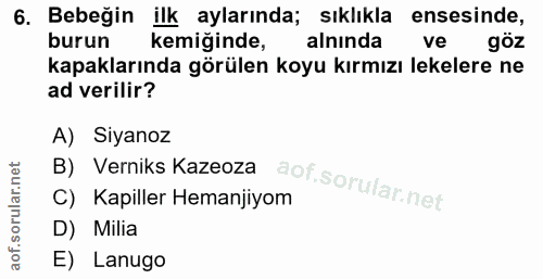 6. soru: Bebeğin ilk aylarında; sıklıkla ensesinde, burun kemiğinde, alnında ve göz kapaklarında görülen koyu kırmızı lekelere…