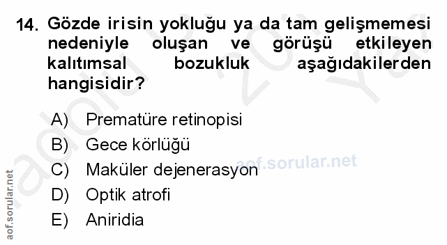14. soru: Gözde irisin yokluğu ya da tam gelişmemesi nedeniyle oluşan ve görüşü etkileyen kalıtımsal bozukluk aşağıdakilerden h…