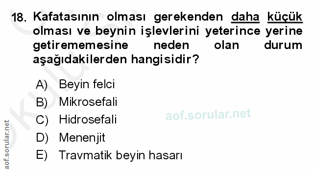 18. soru: Kafatasının olması gerekenden daha küçük olması ve beynin işlevlerini yeterince yerine getirememesine neden olan duru…
