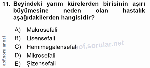 11. soru: Beyindeki yarım kürelerden birisinin aşırı büyümesine neden olan hastalık aşağıdakilerden hangisidir? A) Makrosefali…