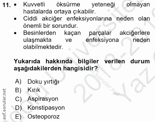11. soru: • Kuvvetli öksürme yeteneği olmayan hastalarda ortaya çıkabilir. • Ciddi akciğer enfeksiyonlarına neden olan önemli b…