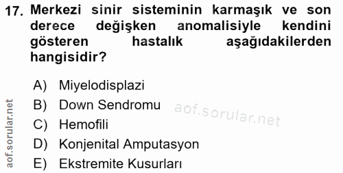 17. soru: Merkezi sinir sisteminin karmaşık ve son derece değişken anomalisiyle kendini gösteren hastalık aşağıdakilerden hangi…