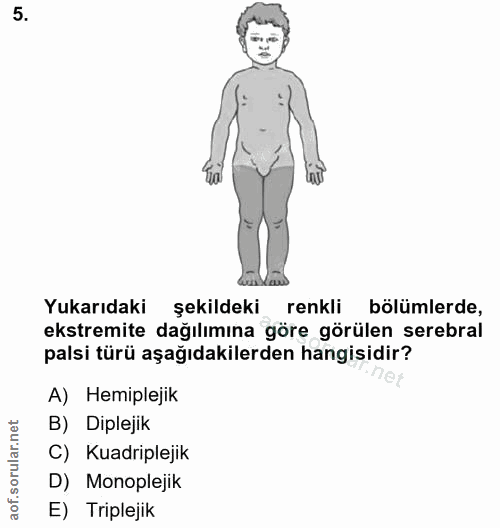 5. soru: Yukarıdaki şekildeki renkli bölümlerde, ekstremite dağılımına göre görülen serebral palsi türü aşağıdakilerden hangis…