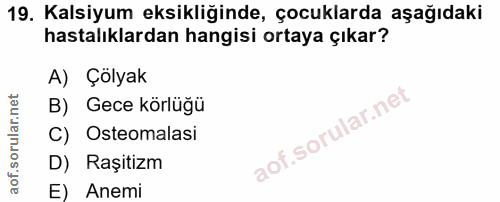 19. soru: Kalsiyum eksikliğinde, çocuklarda aşağıdaki hastalıklardan hangisi ortaya çıkar? A) Çölyak B) Gece körlüğü C) Osteoma…