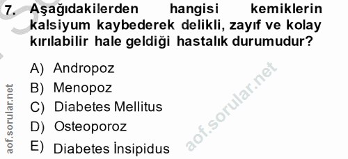 7. soru: Aşağıdakilerden hangisi kemiklerin kalsiyum kaybederek delikli, zayıf ve kolay kırılabilir hale geldiği hastalık duru…