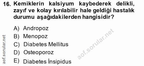 16. soru: Kemiklerin kalsiyum kaybederek delikli, zayıf ve kolay kırılabilir hale geldiği hastalık durumu aşağıdakilerden hangi…