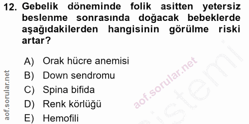 12. soru: Gebelik döneminde folik asitten yetersiz beslenme sonrasında doğacak bebeklerde aşağıdakilerden hangisinin görülme ri…