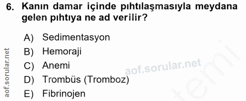 6. soru: Kanın damar içinde pıhtılaşmasıyla meydana gelen pıhtıya ne ad verilir? A) Sedimentasyon B) Hemoraji C) Anemi D) Trom…