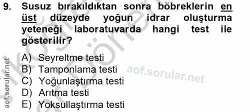 9. soru: Susuz bırakıldıktan sonra böbreklerin en üst düzeyde yoğun idrar oluşturma yeteneği laboratuvarda hangi test ile göst…