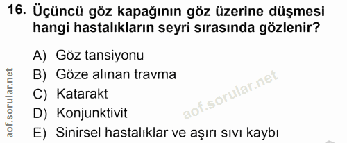 16. soru: Üçüncü göz kapağının göz üzerine düşmesi hangi hastalıkların seyri sırasında gözlenir? A) Göz tansiyonu B) Göze alına…