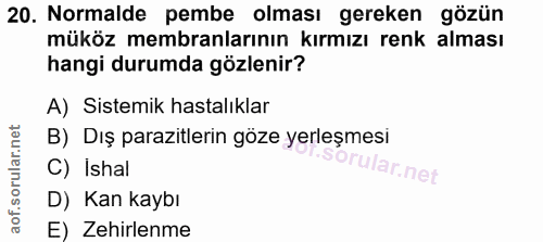 20. soru: Normalde pembe olması gereken gözün müköz membranlarının kırmızı renk alması hangi durumda gözlenir? A) Sistemik hast…