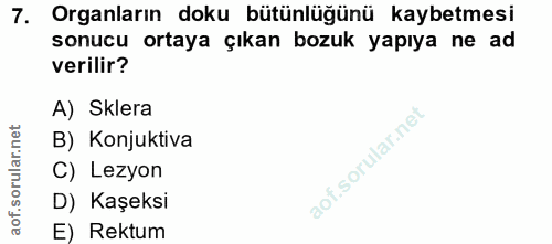 7. soru: Organların doku bütünlüğünü kaybetmesi sonucu ortaya çıkan bozuk yapıya ne ad verilir? A) Sklera B) Konjuktiva of. C)…