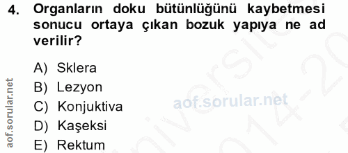 4. soru: Organların doku bütünlüğünü kaybetmesi sonucu ortaya çıkan bozuk yapıya ne ad verilir? A) Sklera B) Lezyon C) Konjukt…