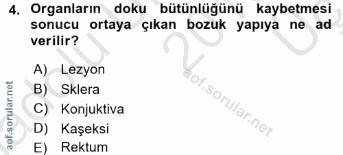 4. soru: Organların doku bütünlüğünü kaybetmesi sonucu ortaya çıkan bozuk yapıya ne ad verilir? A) Lezyon B) Sklera of. Konjuk…