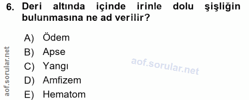 6. soru: Deri altında içinde irinle dolu şişliğin bulunmasına ne ad verilir? A) Ödem B) Apse C) Yangı D) Amfizem E) Hematom