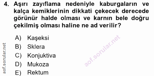 4. soru: Aşırı zayıflama nedeniyle kaburgaların ve kalça kemiklerinin dikkati çekecek derecede görünür halde olması ve karnın…