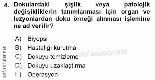 4. soru: Dokulardaki şişlik veya patolojik değişikliklerin tanımlanması için organ ve lezyonlardan doku örneği alınması işlemi…