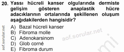 20. soru: Yassı hücreli kanser olgularında dermiste gelişim gösteren anaplastik hücre adacıklarının ortalarında şekillenen oluş…