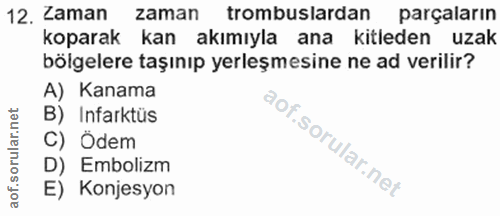12. soru: Laman zaman trombuslardan parçaların koparak kan akımıyla ana kitleden uzak bölgelere taşınıp yerleşmesine ne ad veri…