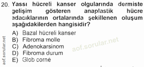 20. soru: Yassı hücreli kanser olgularında dermiste gelişim gösteren anaplastik hücre adacıklarının ortalarında şekillenen oluş…