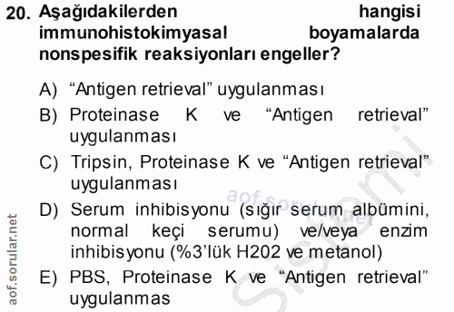 20. soru: Aşağıdakilerden hangisi immunohistokimyasal boyamalarda onspesifik reaksiyonları engeller? A) "Antigen retrieval" uyg…
