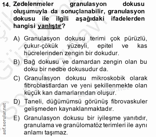 14. soru: Zedelenmeler granulasyon dokusu oluşumuyla da sonuçlanabilir, granulasyon dokusu ile ilgili aşağıdaki ifadelerden han…