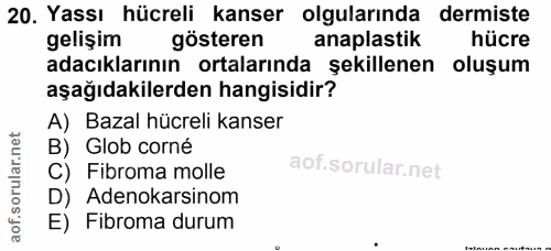 20. soru: Yassı hücreli kanser olgularında dermiste gelişim gösteren anaplastik hücre adacıklarının ortalarında şekillenen oluş…