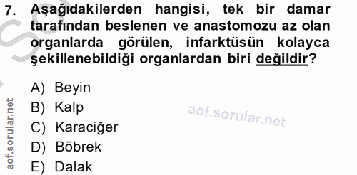 7. soru: Aşağıdakilerden hangisi, tek bir damar tarafından beslenen ve anastomozu az olan organlarda görülen, infarktüsün kola…