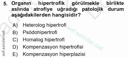 5. soru: Organın hipertrofik görülmekle birlikte aslında atrofiye uğradığı patolojik durum aşağıdakilerden hangisidir? A) Hete…