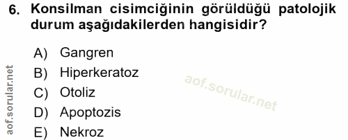 6. soru: Konsilman cisimciğinin görüldüğü patolojik durum aşağıdakilerden hangisidir? A) Gangren B) Hiperkeratoz C) Otoliz D)…