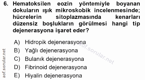 6. soru: Hematoksilen eozin yöntemiyle boyanan dokuların ışık mikroskobik incelenmesinde; hücrelerin sitoplazmasında kenarları…