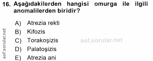16. soru: Aşağıdakilerden hangisi omurga ile ilgili anomalilerden biridir? A) Atrezia rekti B) Kifozis C) Torakoşizis D) Palato…