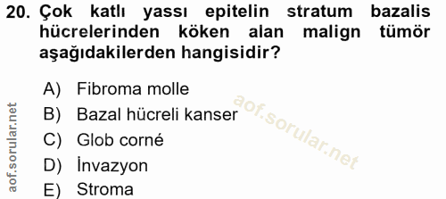 20. soru: Çok katlı yassı epitelin stratum bazalis hücrelerinden köken alan malign tümör aşağıdakilerden hangisidir? A) Fibroma…