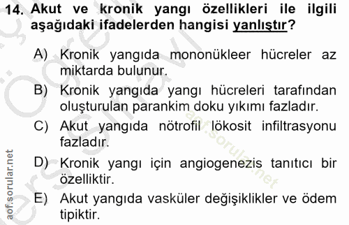14. soru: Akut ve kronik yangı özellikleri ile ilgili aşağıdaki ifadelerden hangisi yanlıştır? A) Kronik yangıda mononükleer hü…