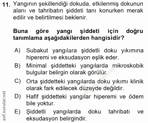 11. soru: Yangının şekillendiği dokuda, etkilenmiş dokunun alanı ve tahribatın şiddeti tanı konurken merak edilir ve belirtilme…