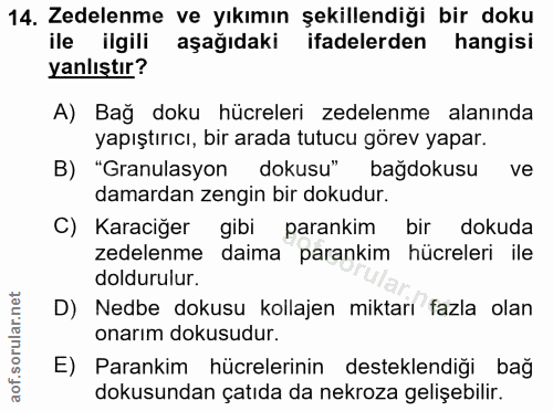 14. soru: Zedelenme ve yıkımın şekillendiği bir doku ile ilgili aşağıdaki ifadelerden hangisi yanlıştır? A) Bağ doku hücreleri…