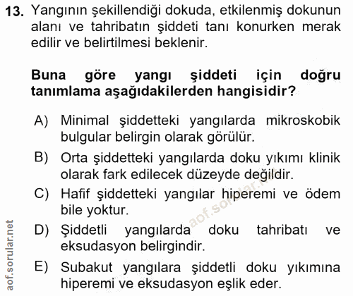 13. soru: Yangının şekillendiği dokuda, etkilenmiş dokunun alanı ve tahribatın şiddeti tanı konurken merak edilir ve belirtilme…