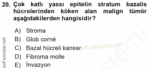 20. soru: Çok katlı yassı epitelin stratum bazalis hücrelerinden köken alan malign tümör aşağıdakilerden hangisidir? A) Stroma…