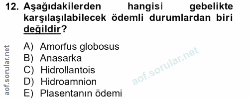 12. soru: Aşağıdakilerden hangisi gebelikte karşılaşılabilecek ödemli durumlardan biri değildir? A) Amorfus globosus B) Anasark…