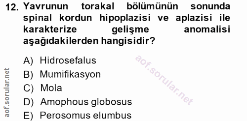 12. soru: Yavrunun torakal bölümünün sonunda spinal kordun hipoplazisi ve aplazisi ile karakterize gelişme anomalisi aşağıdakil…