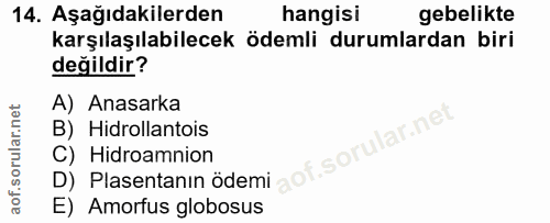 14. soru: Aşağıdakilerden hangisi gebelikte karşılaşılabilecek ödemli durumlardan biri değildir? A) Anasarka B) Hidrollantois D…