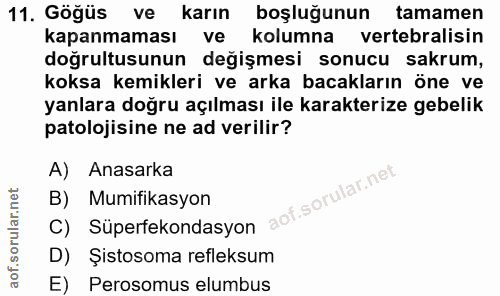 11. soru: Göğüs ve karın boşluğunun tamamen kapanmaması ve kolumna vertebralisin doğrultusunun değişmesi sonucu sakrum, koksa k…