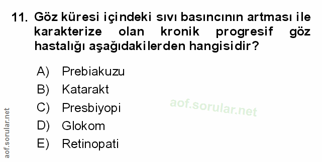 11. soru: Göz küresi içindeki sıvı basıncının artması ile karakterize olan kronik progresif göz hastalığı aşağıdakilerden hangi…