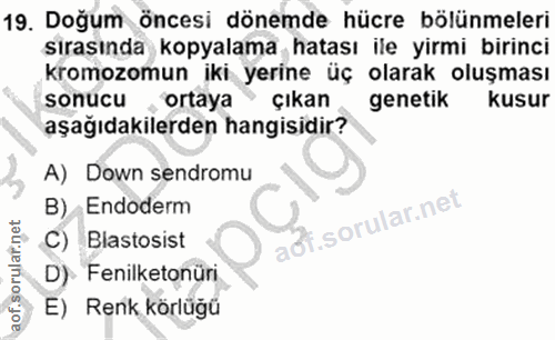 19. soru: Doğum öncesi dönemde hücre bölünmeleri sırasında kopyalama hatası ile yirmi birinci kromozomun iki yerine üç olarak o…