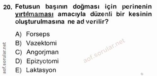20. soru: Fetusun başının doğması için perinenin yırtılmaması amacıyla düzenli bir kesinin oluşturulmasına ne ad verilir? A) Fo…