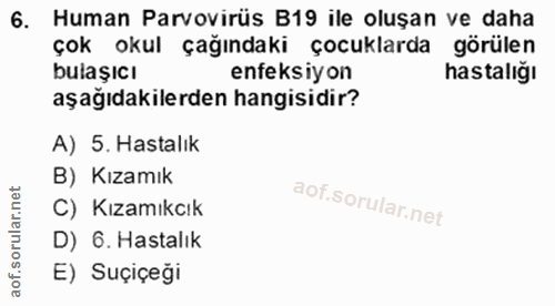 6. soru: Human Parvovirüs B19 ile oluşan ve daha bulasokul çağındakisıçocuklarda astülen bulaşıcı enfeksiyon aşağıdakilerden h…
