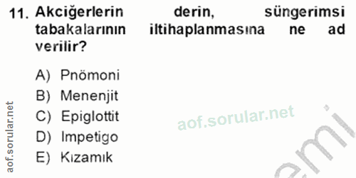 11. soru: Akcigerlerin derin, süngerimsi tabakalarının iltihaplanmasına ne ad verilir? A) Pnömoni B) Menenjit C) Epiglottit D)…