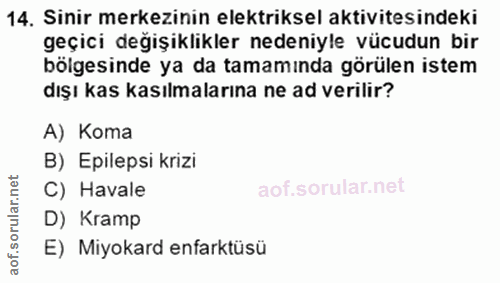 14. soru: Sinir merkezinin elektriksel aktivitesindeki geçici değişıklıkler nedeniyle vücudun bir bölgesinde ya da tamamında gö…